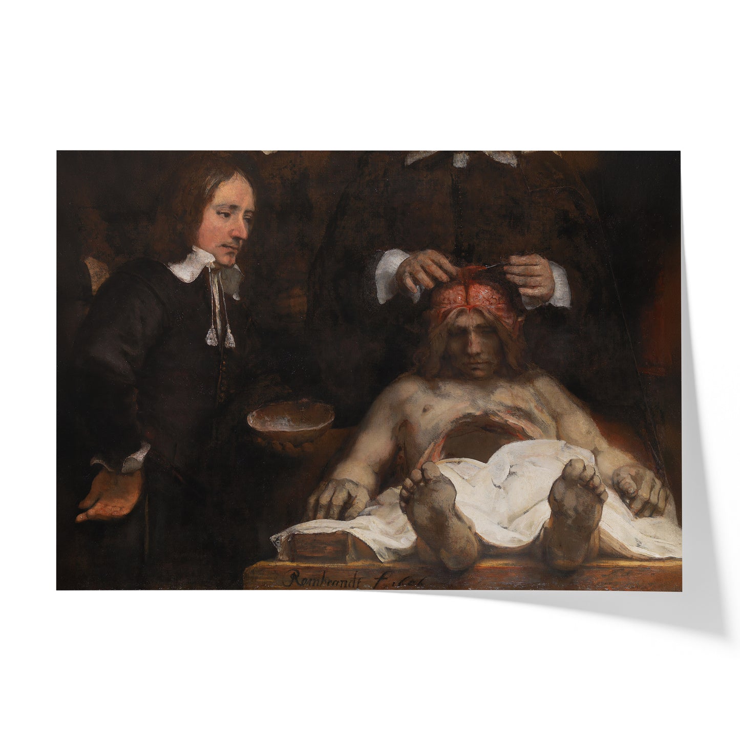 The Anatomy Lesson Of Dr. Jan Deijman | Rembrandt | 1656